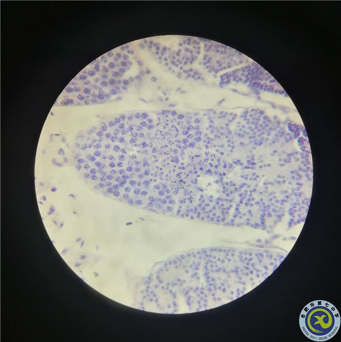周涛 蝗虫减数分裂.jpg 周涛 蝗虫减数分裂.jpg